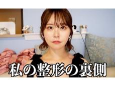 「短期では難しい」“整形アイドル”YouTuber、クマ取り整形の真実を明かす「信頼できます」