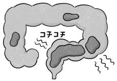 毎日お通じがあっても“残便感”があれば便秘!? 便秘の基礎知識＆6つの主な原因を解説