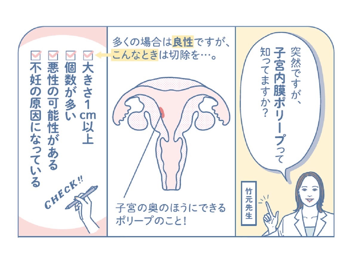 「生理が重い」と感じる人は一度検査を！ 意外と知られていない「子宮内膜ポリープ」を解説