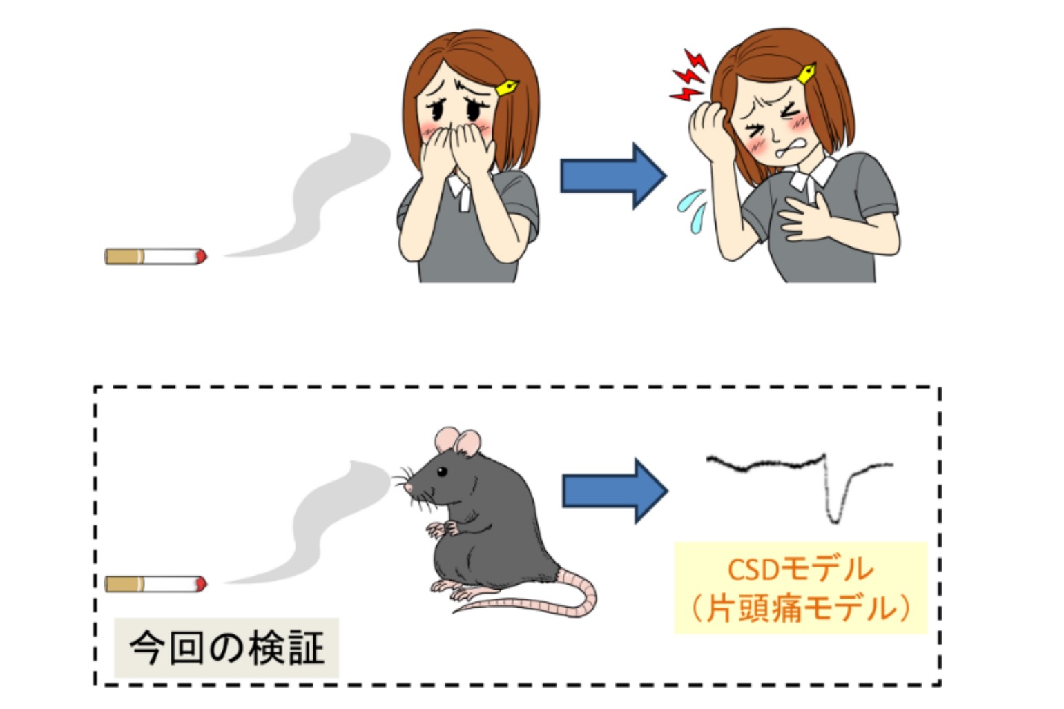 受動喫煙が女性の片頭痛リスクを高める可能性　慶應義塾大学の研究グループが発表