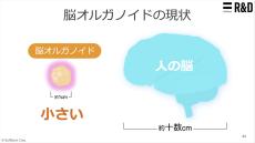 実用化は50年後!? ソフトバンクがいち早く研究を進める”脳細胞”を活用したコンピューター