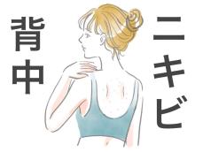 気づかないうちに背中にポツポツが！医師に聞いた「背中のニキビ対策」