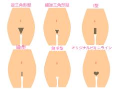 どの形が人気？アンダーヘアの脱毛について医師に聞きました