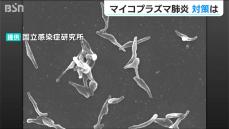 マイコプラズマ肺炎「9月、10月になってから一気に流行ってますね」 “これまでにないペース”で急増か　医師に聞く対策は？