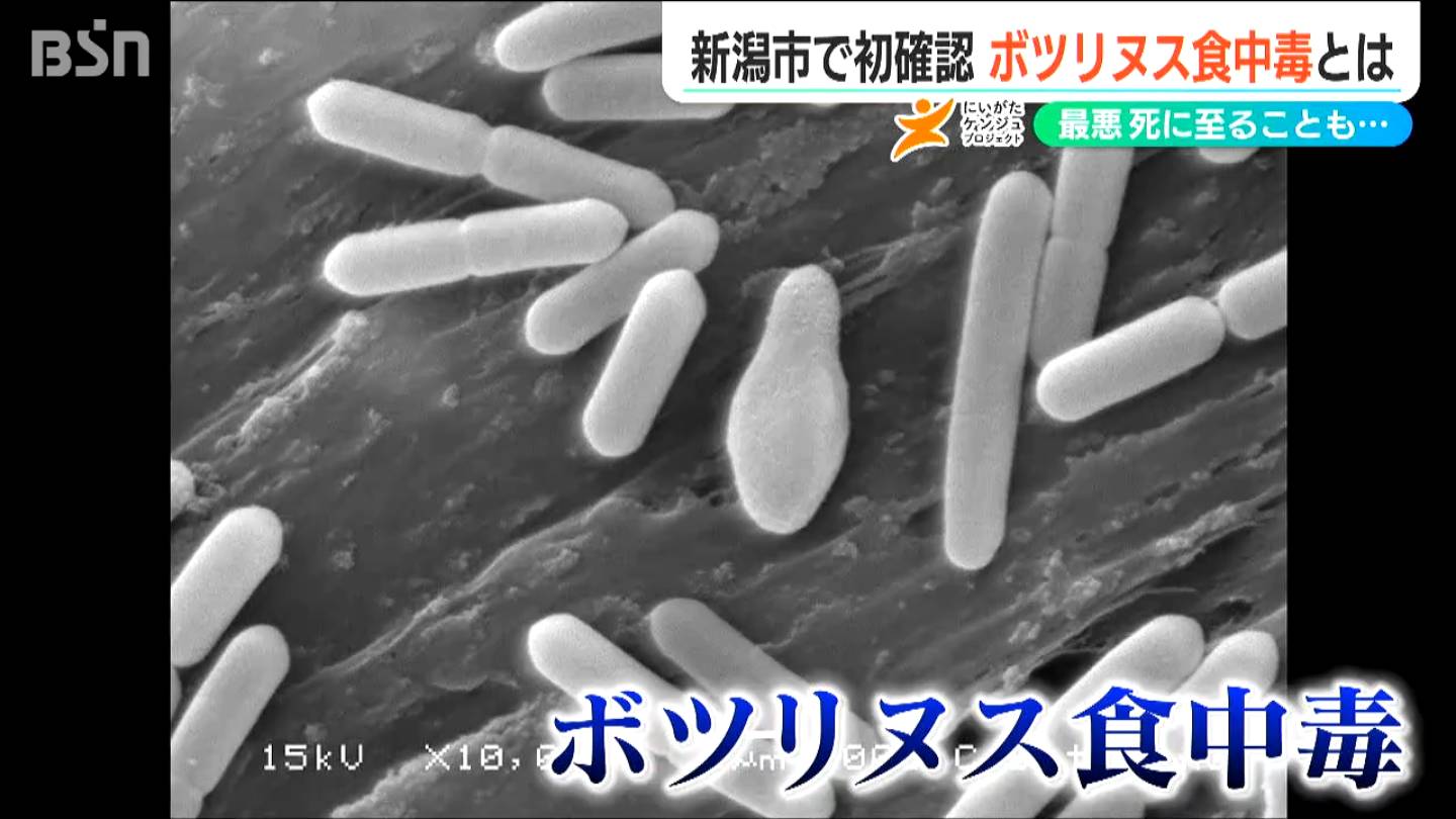 最悪の場合は「死に至る」新潟で初確認された『ボツリヌス食中毒』を防ぐための注意点