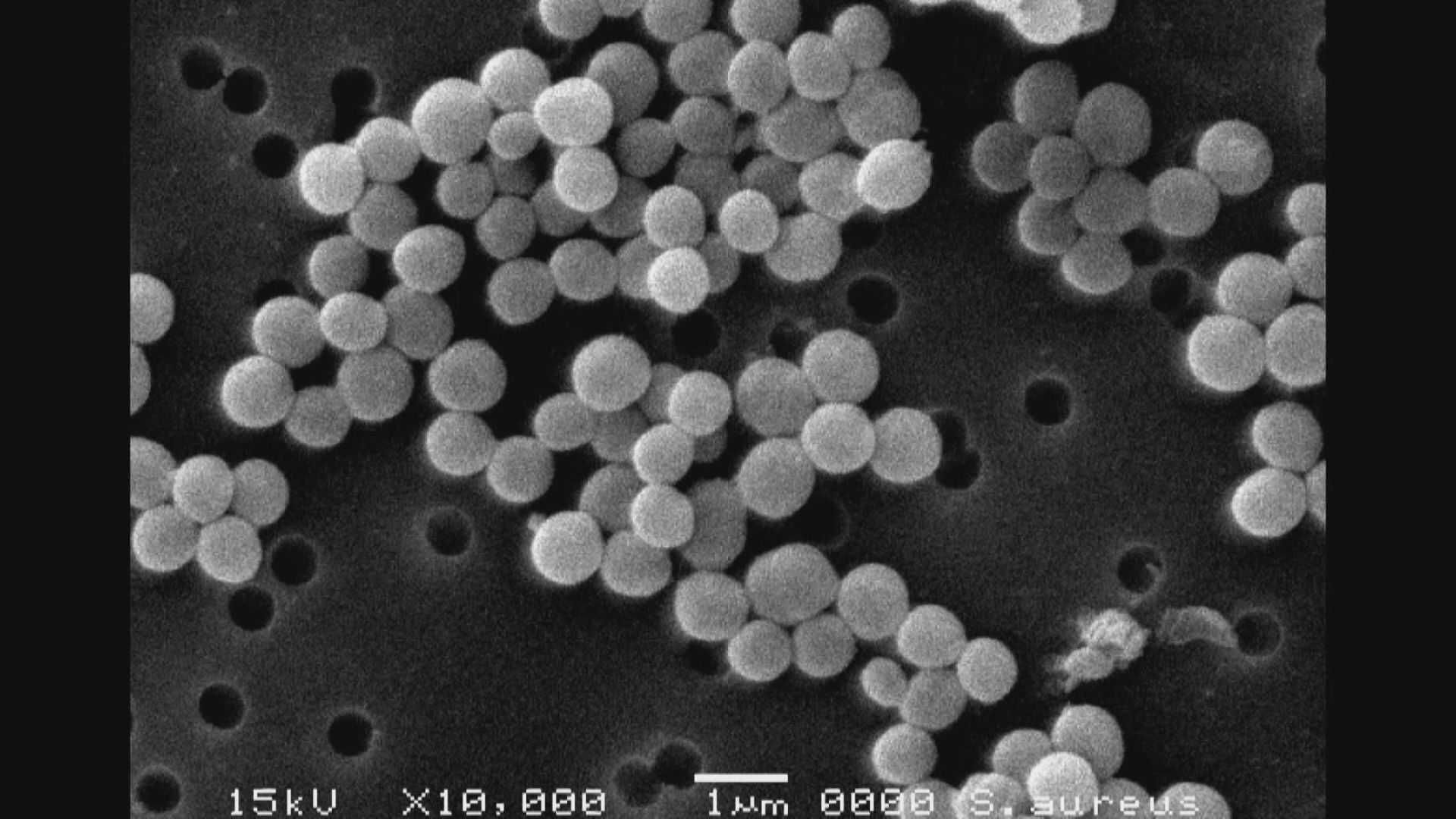 【黄色ブドウ球菌】常に手指・顔などにいる恐れ “家庭でも注意を” 土用の丑の日のうなぎで集団食中毒