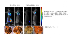 血管をターゲットに！ TGF-β/CD44抑制でがん血行性転移を阻止～がん転移の予防・治療への応用に期待