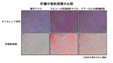 水溶性食物繊維 "グアーガム分解物" のアルコール性脂肪肝の改善効果を解明　腸内環境の改善が肝疾患の予防に有用である可能性--摂南大学