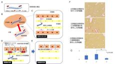 【東京医科大学】肝線維化を制御する経口投与可能な核酸医薬品の開発　～ 飲み薬で肝硬変を改善する方法を目指して 〜