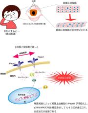 どうして眼をこすってはいけないのか？  新たな理由を発見 ～機械的刺激が目の炎症を引き起こす仕組みを解明～