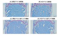 筋肉および骨の維持には、糖質とタンパク質の適切な摂取が不可欠なことを明らかに