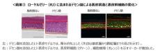 ローヤルゼリーが肌の再生や老化抑制に関わる表皮幹細胞を活性化し、ターンオーバーを促進することで肌の若返りを促す可能性　ローヤルゼリーの肌に対する有用性メカニズムの一部を解明