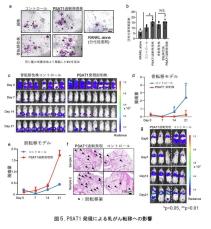 【東京医科大学】がん細胞をはじめとする種々のエクソソーム分泌の新たな機序解明　～ 乳がんなどのがん転移阻害剤の開発に貢献する可能性 ～