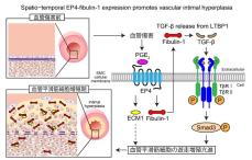 【東京医科大学】心筋梗塞におけるステント留置後の再狭窄にプロスタグランディンE受容体EP4によるFibulin-1の産生亢進が関与　～内膜肥厚形成を抑制する新たな治療戦略となる可能性を示唆～