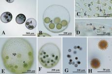 法政大学植木教授らが東京都で128年ぶりに植物プランクトン「ボルボックス」を再発見