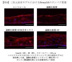 皮脂の酸化が頭皮のかゆみの一因となるメカニズムを確認