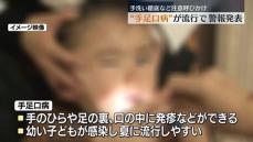 幼い子どもが感染…手足口病の患者数が増加で警報発表　福島県が注意呼びかけ