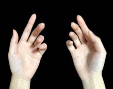 指が変形する「へバーデン結節」は最新治療で進行を食い止める