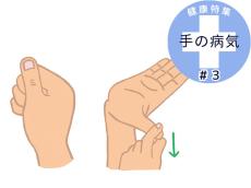 指の痛みと腫れを改善！専門医が教える「指エクササイズ」2