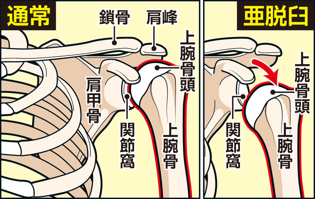 大谷はＷＳ出場できるのか？整形外科専門医解説「可動域もよく、力も入るということならば…」