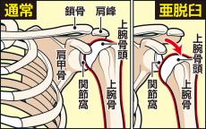 大谷はＷＳ出場できるのか？整形外科専門医解説「可動域もよく、力も入るということならば…」