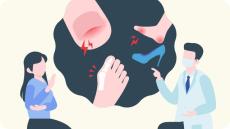巻き爪の放置は転倒の原因や健康に影響も！正しい靴選びを専門家が伝授