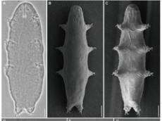 最強生物クマムシの新種、“人が即死レベルの放射線”を浴びると活性化　中国チームが発表