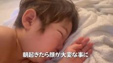 朝起きたら1歳息子の顔に異変→急いで病院に行ったら……　シングルマザーの奮闘ぶりに「アクティブすぎて本当尊敬」