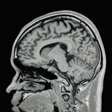 「研究のために自分の脳をMRI撮影」→よく見ると……　浮かんでくる“有名キャラ”に仰天「はちみつ食～べたいな～」