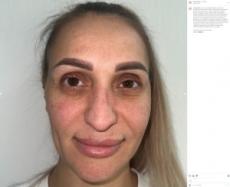 【海外発！Breaking News】トルコで美容整形した女性、スーパーモデルのような顔に「変わりすぎて怖い」「新しいパスポートが必要」の声