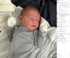 【海外発！Breaking News】「大きなコブ？」いびつな形の頭で誕生した赤ちゃん、24時間以内の変化に驚愕（米）