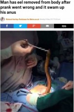 【海外発！Breaking News】肛門に生きたウナギを入れた中国の男性、激痛で胃から摘出手術＜閲覧注意＞