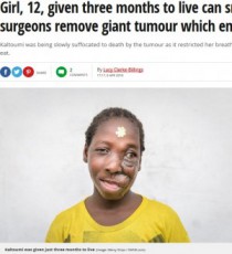 【海外発！Breaking News】顔にサッカーボール大の腫瘍を抱えた少女、手術で笑顔を取り戻す（カメルーン）