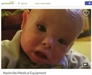 海外発 Breaking News 漂白剤のお風呂に週に2回 道化師様魚鱗癬と闘う1歳児 米 記事詳細 Infoseekニュース 海外発 Breaking News 漂白剤のお風呂に週に2回 道化師様魚鱗癬と闘う1歳児 米 記事詳細 Infoseekニュース