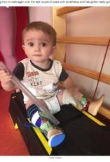【海外発！Breaking News】「助かる確率は0.1％」敗血症で両脚を切断した2歳男児が三輪車に乗れるように（ポーランド）