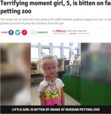 【海外発！Breaking News】動物園のふれあい体験でヘビが5歳女児の顔に噛みつく　ランチで食べたチキンの匂いが原因か（露）＜動画あり＞