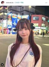 整形アイドル、「ビフォーアフター」写真で回想　「私より奥目な人出会ったことない」