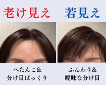 “分け目”の老けサイン､解消方法
