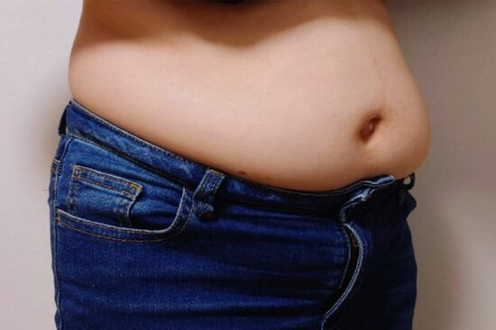 名医が指導、3か月で平均5kg減の「脱・脂肪肝ダイエット」脂肪の放置は病を招く