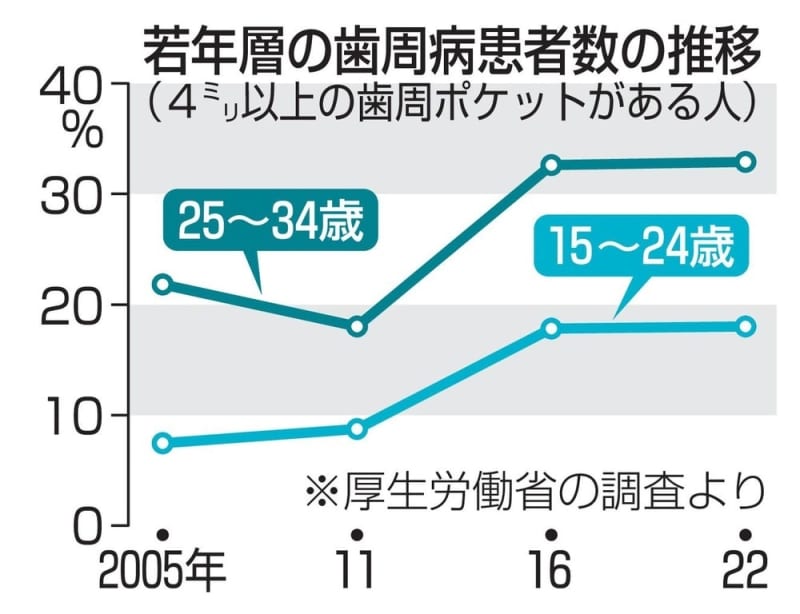 歯周病検診に20歳、30歳追加　4月以降、若年患者増加で厚労省