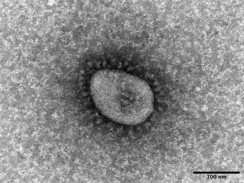 コロナ感染で慢性疲労リスク4倍　米、後遺症頻度高く「予防策を」