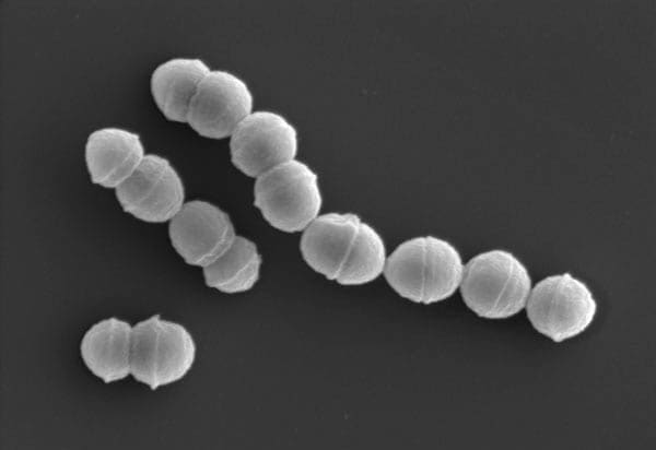 「劇症溶連菌」患者、最多ペース　昨年上回る、毒素多い株も