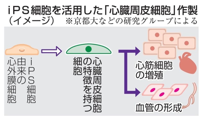 iPSで「心臓周皮細胞」　新たな心不全治療の開発も