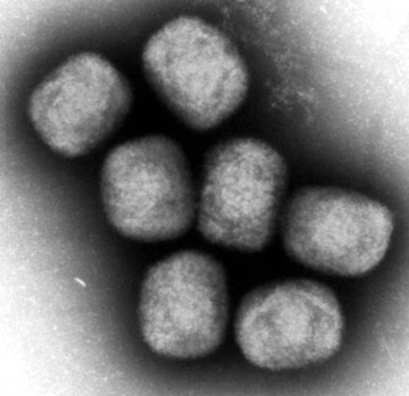 コンゴでワクチン接種開始　エムポックス、対策本格化