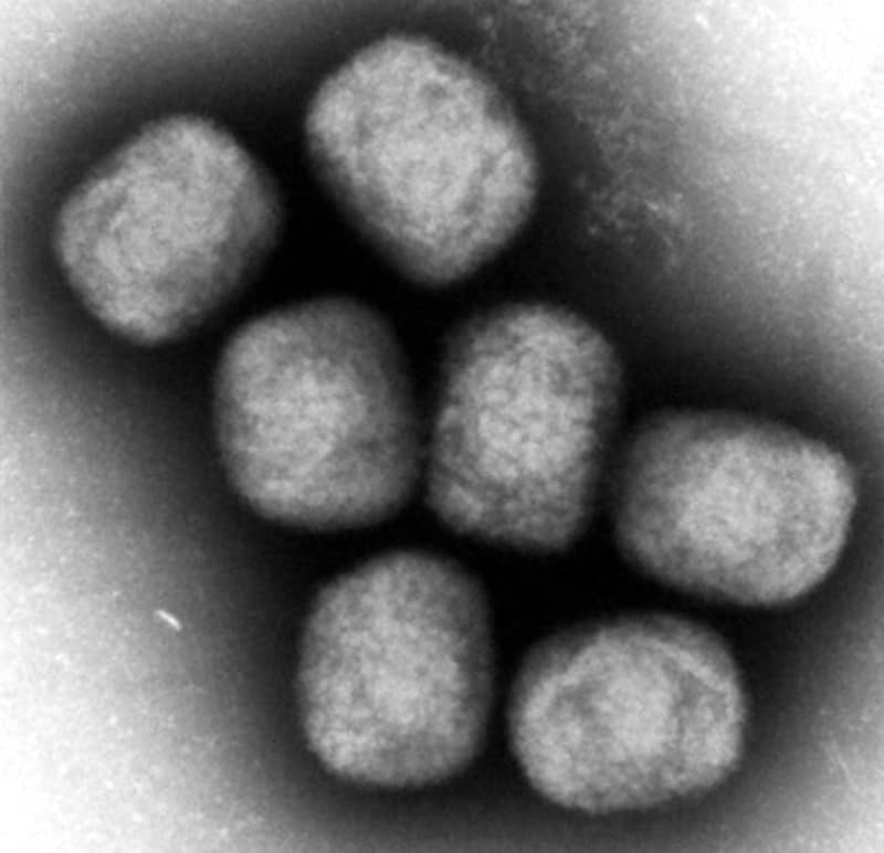 米国で初のエムポックス重症型　感染者、アフリカに渡航歴