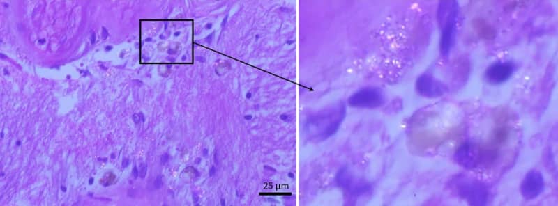 プラスチック微粒子、脳内に蓄積　腎臓や肝臓より7～30倍の濃度