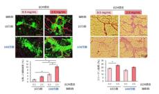 骨格筋の再生医療に新展開！ ―培養筋芽細胞の移植による筋量増加を実証―