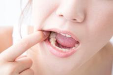 更年期は歯周病に要注意！歯科医師に聞く「健康な口もとの保ち方」