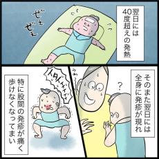 【漫画】やせ細って痛々しい…3歳息子が”手足口病”に「見るのもつらいですよね」【作者インタビュー】