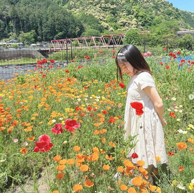 身長123センチ…低身長の“現役女子大生モデル”が、「明るい日常」を発信する理由　10万人に1人の希少疾患『2型コラーゲン異常症』と生きる日々